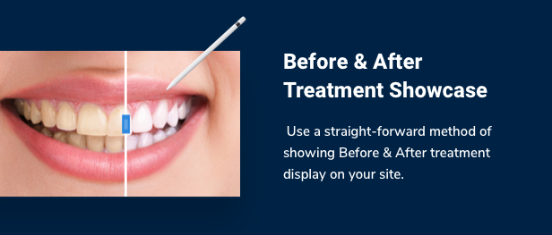 SmilePure – Dental Medical Care WordPress Theme - Image 4